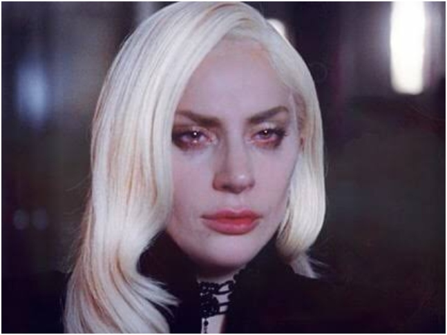 lady-gaga-ne-gjendje-te-rende-shendetesore-ylli-i-muzikes-pop-ben-deklaraten-shqetesuese