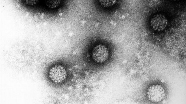 a-e-rrit-hpv-rrezikun-e-kancerit-te-qafes-se-mitres