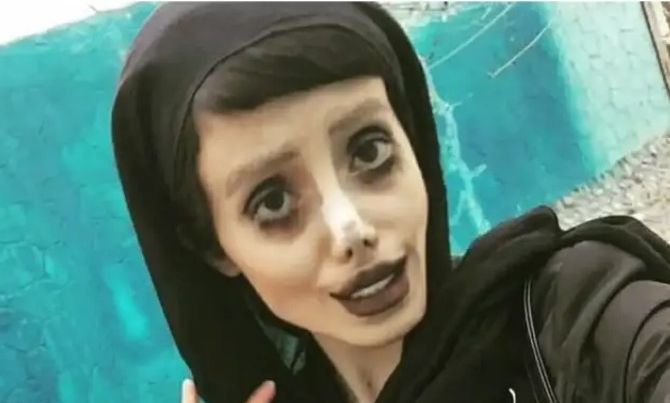 imazhi-qe-tronditi-rrjetin-zombi-angelina-jolie-zbulon-fytyren-e-vertete-pas-fames-virale