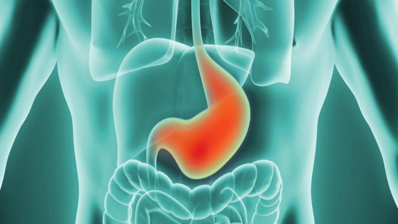 problemet-me-aciditetin-e-stomakut-gjate-agjerimit-ja-si-ta-mbani-nen-kontroll-dhe-pa-pasur-shqetesime