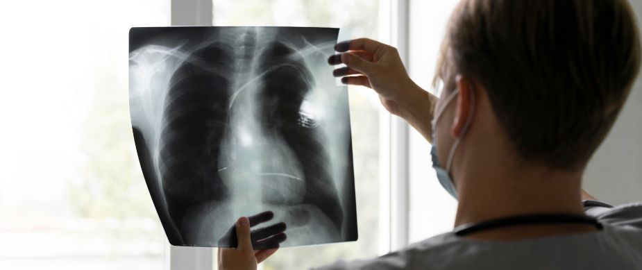 pneumonia-cfare-e-shkakton-si-transmetohet-kush-eshte-me-i-rrezikuar