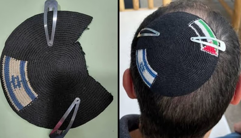 qytetari-denoncon-policine-per-abuzim-ndalohet-per-kapelen-me-dy-flamuj