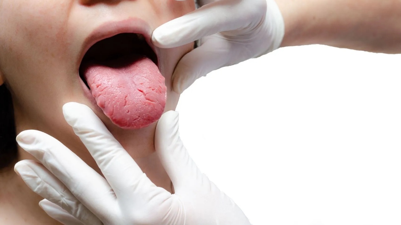 ngjyra-e-gjuhes-mund-te-tregoje-problemet-e-zemres