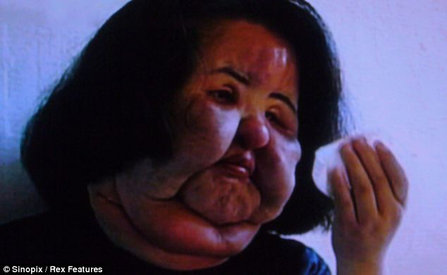 kirurgjia palstike.jpg2