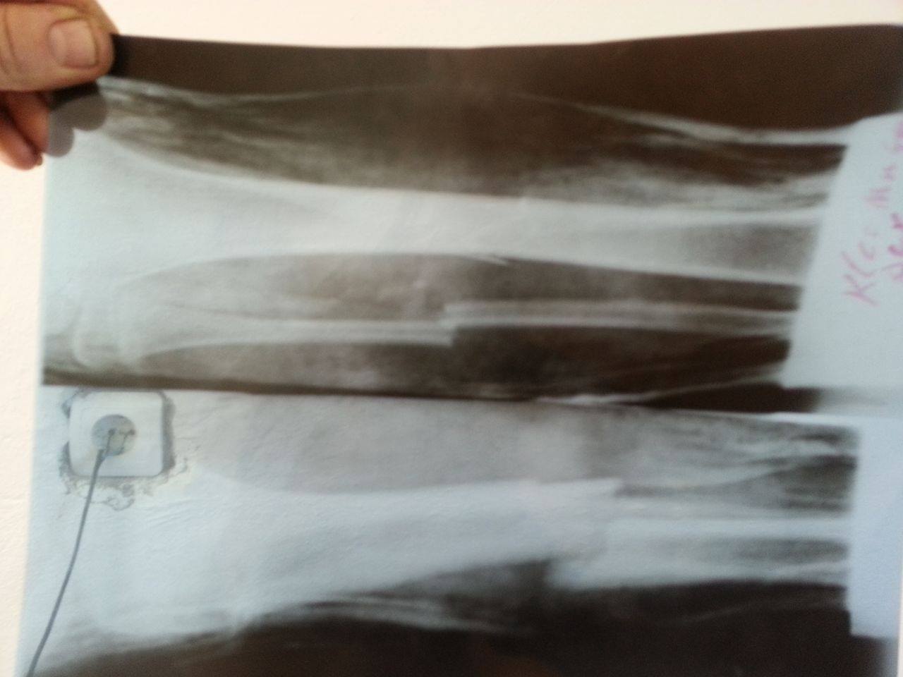 lenci_1461240948-8965740